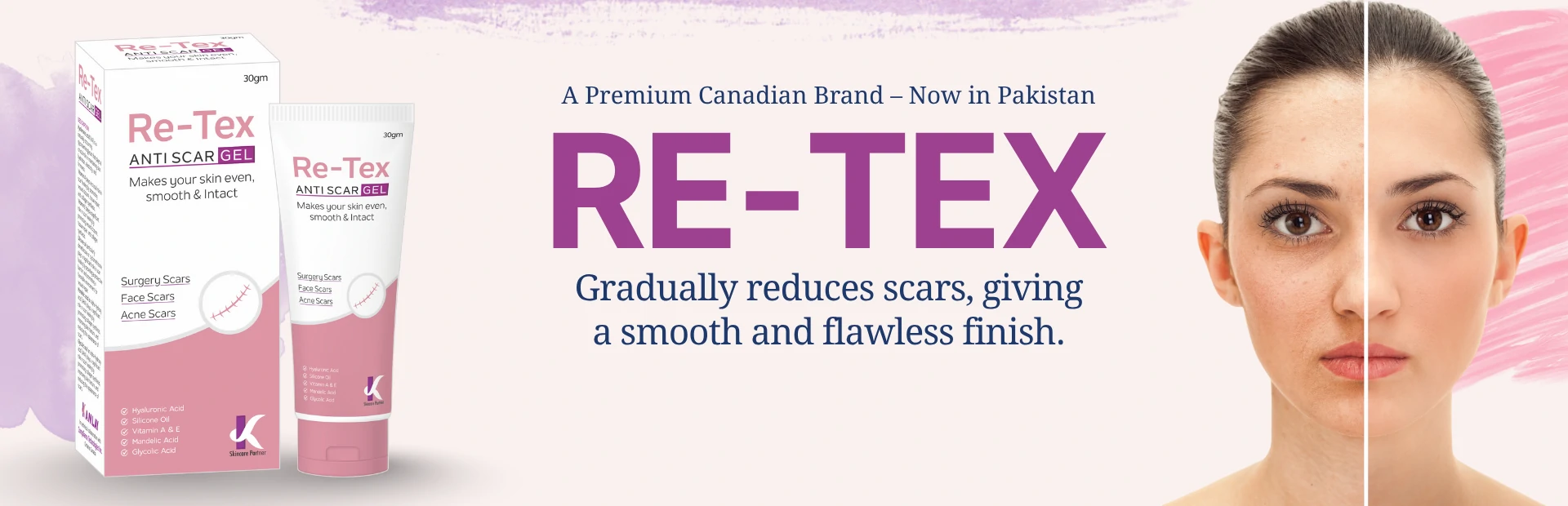 Retex-Banner